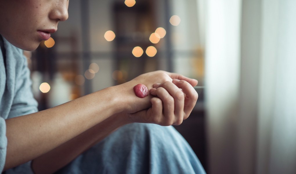 personne-tache-rouge-bras-fenetre